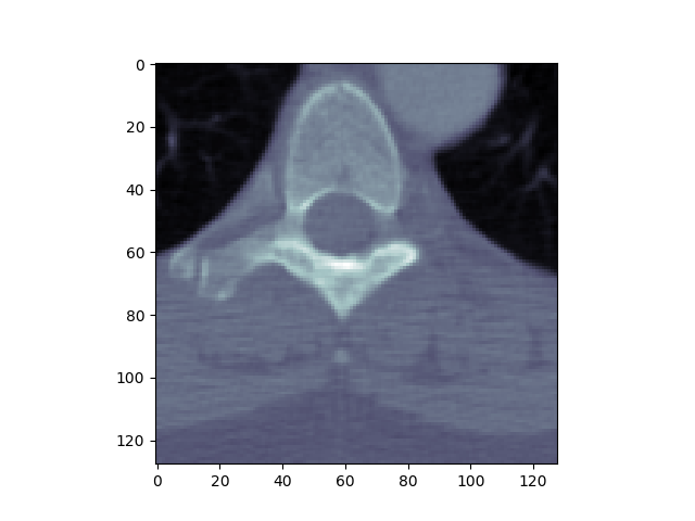 ../_images/sphx_glr_plot_read_dicom_001.png